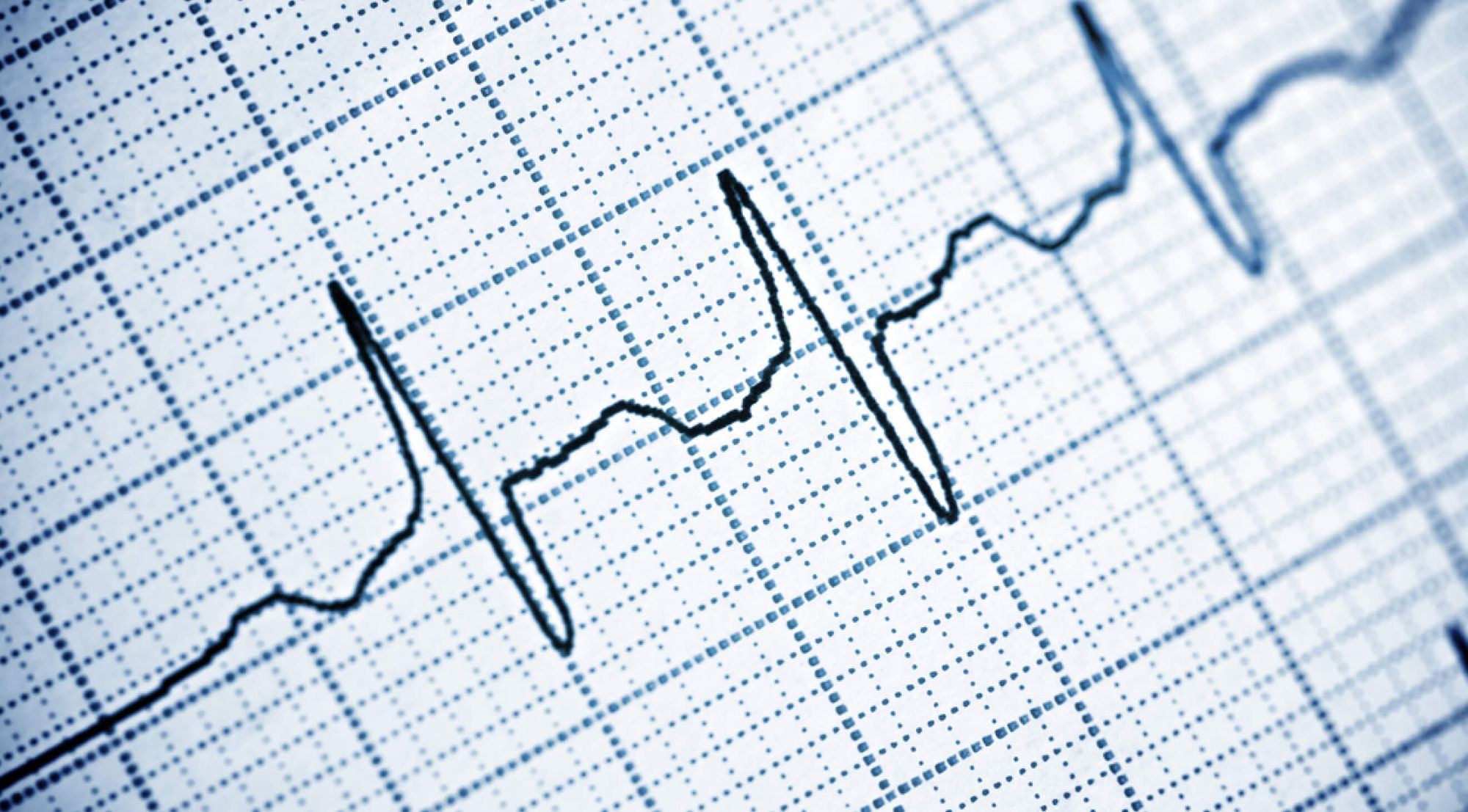 What is employee pulse check: Best practices and survey questions to ask in 2026