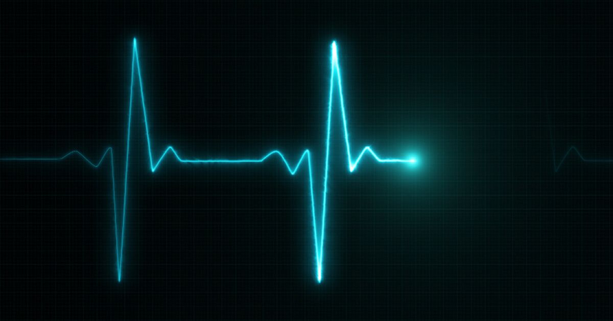 What is the purpose of employee pulse surveys